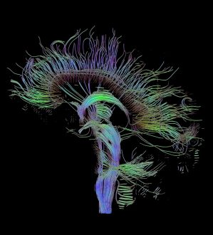 Command Z - Esozone Codex Brain Change Course